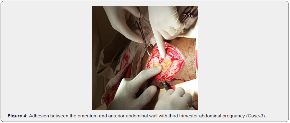 Click here to view Large Figure 4