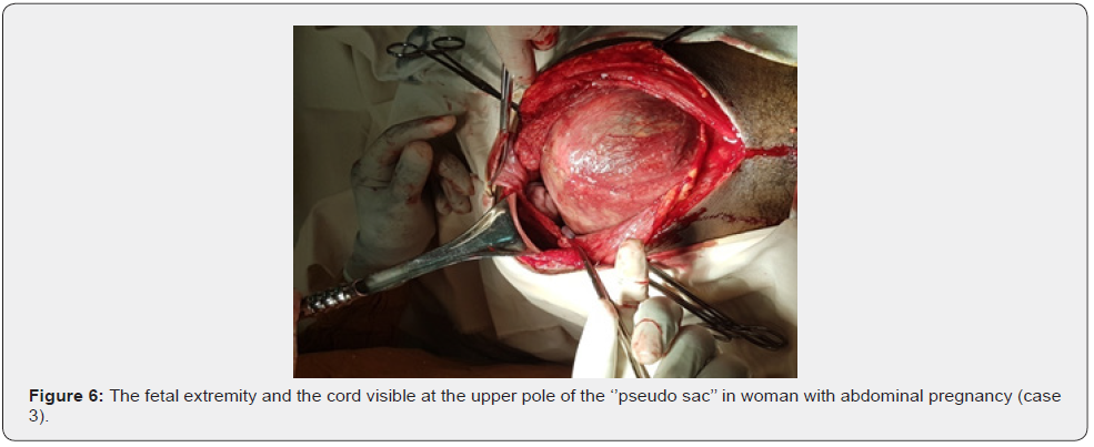 Click here to view Large Figure 6