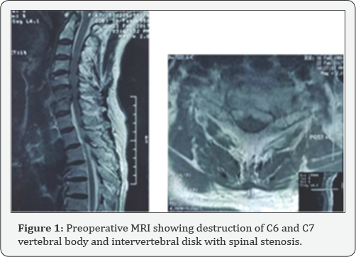 Click here to view Large Figure 1