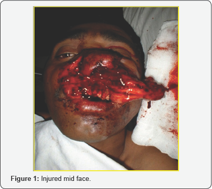 Click here to view Large Figure 1