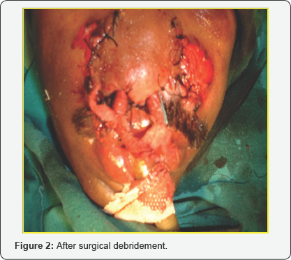 Click here to view Large Figure 2