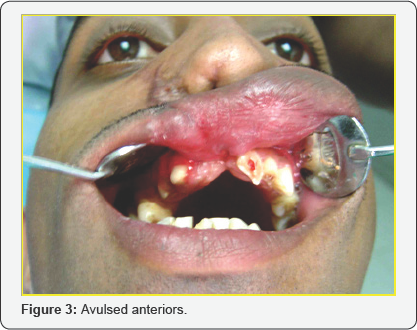 Click here to view Large Figure 3