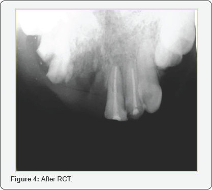 Click here to view Large Figure 4
