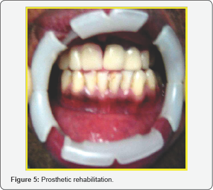 Click here to view Large Figure 5