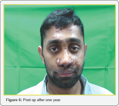 Click here to view Large Figure 6