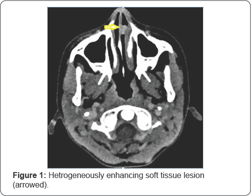 Click here to view Large Figure 1