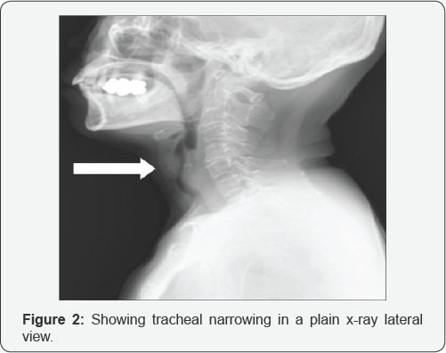Click here to view Large Figure 2