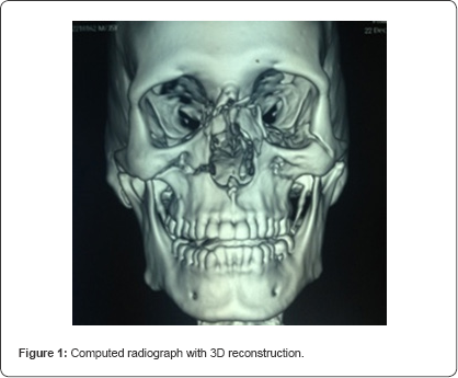 Click here to view Large Figure 1