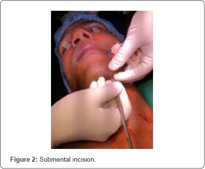 Click here to view Large Figure 2