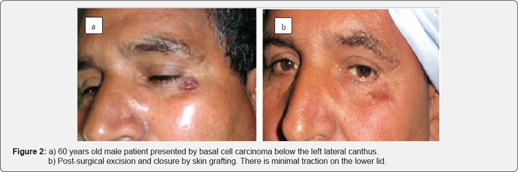 Click here to view Large Figure 2