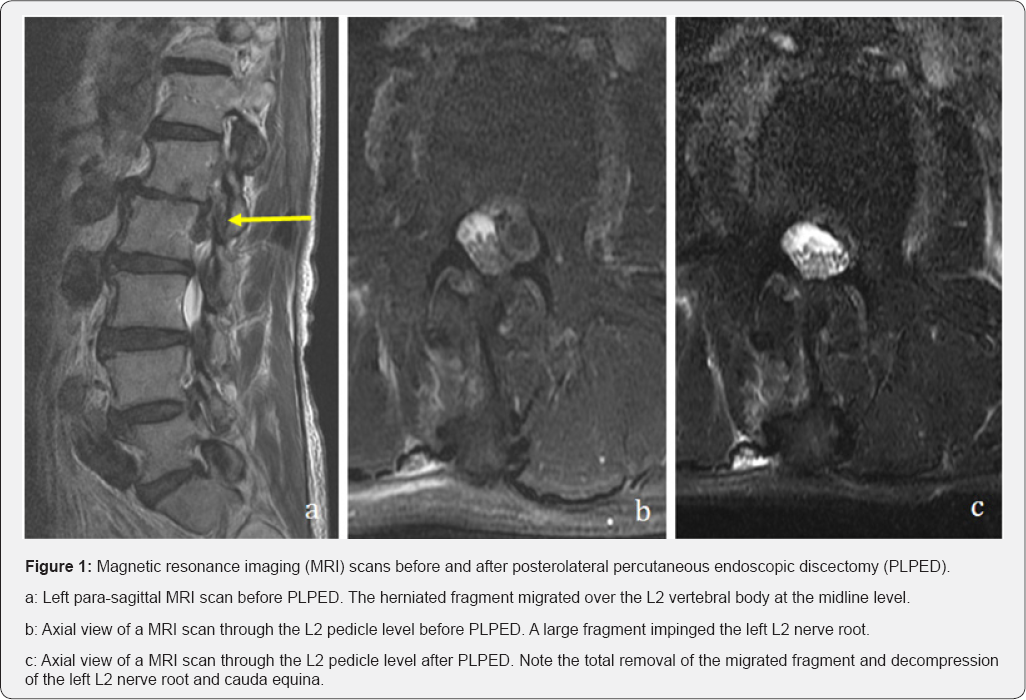 Click here to view Large Figure 1