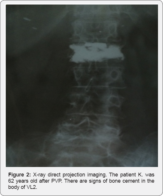 Click here to view Large Figure 2