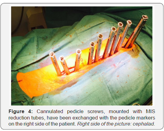 Click here to view Large Figure 4