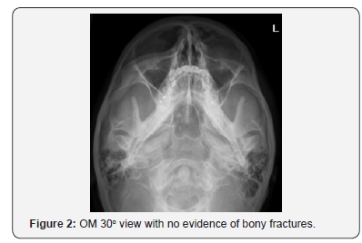 Click here to view Large Figure 2