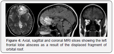 Click here to view Large Figure 4