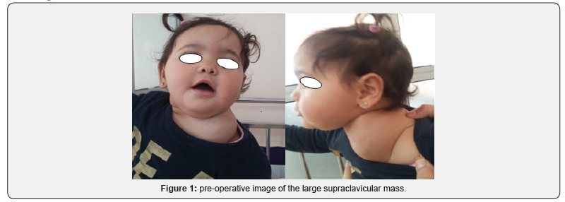 Click here to view Large Figure 1 Journal of Head Neck & Spine Surgery