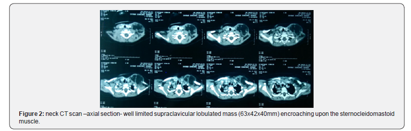 Click here to view Large Figure 2 Journal of Head Neck & Spine Surgery