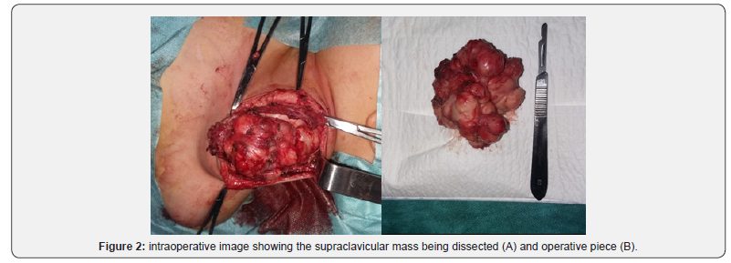 Click here to view Large Figure 3 Journal of Head Neck & Spine Surgery