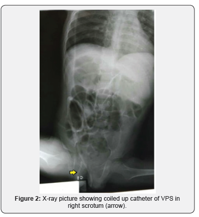 Click here to view Large Figure 2 Journal of Head Neck & Spine Surgery