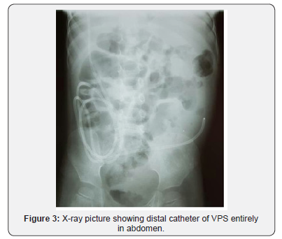 Click here to view Large Figure 3 Journal of Head Neck & Spine Surgery