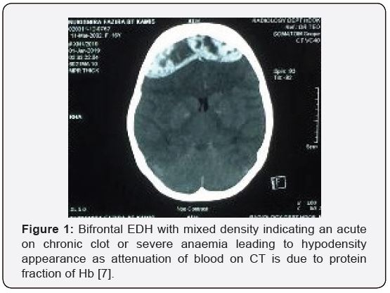 Click here to view Large Figure 1