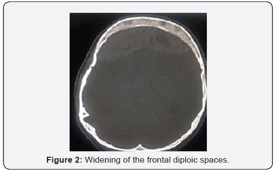 Click here to view Large Figure 2