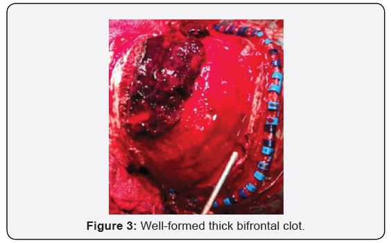 Click here to view Large Figure 3
