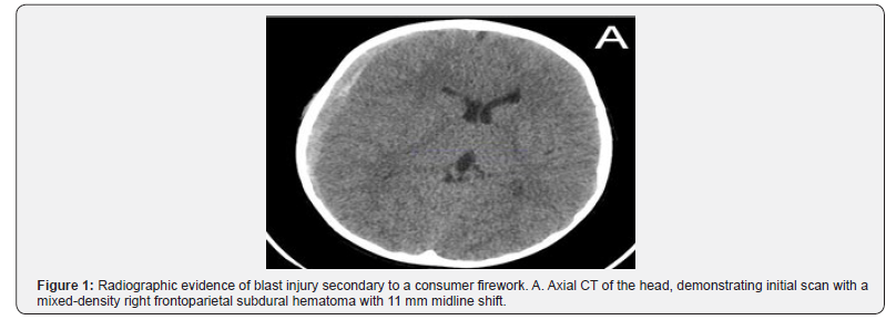 Click here to view Large Figure 1 Journal of Head Neck & Spine Surgery