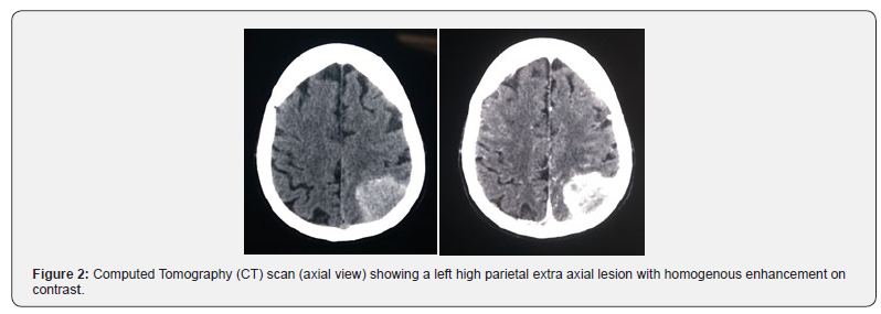 Click here to view Large Figure 2 Journal of Head Neck & Spine Surgery
