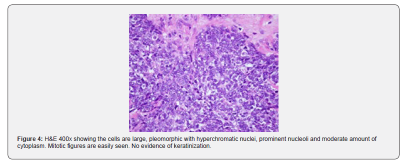 Click here to view Large Figure 4 Journal of Head Neck & Spine Surgery
