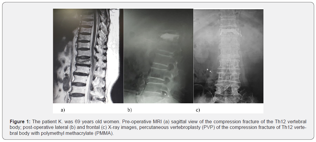 Click here to view Large Figure 1 Journal of Head Neck & Spine Surgery