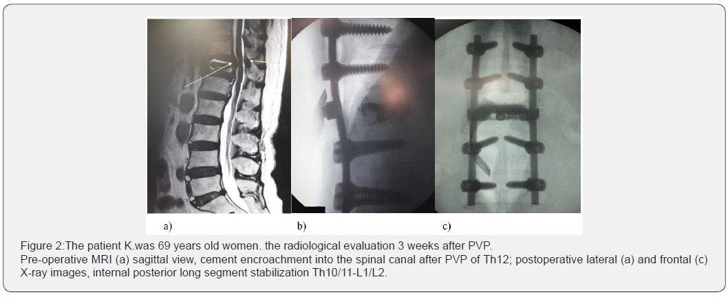 Click here to view Large Figure 2 Journal of Head Neck & Spine Surgery