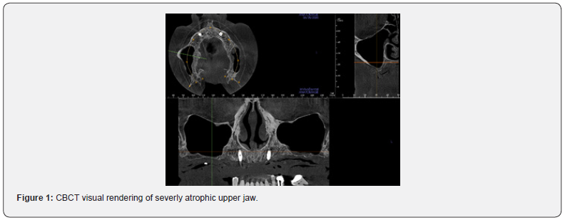 Click here to view Large Figure 1