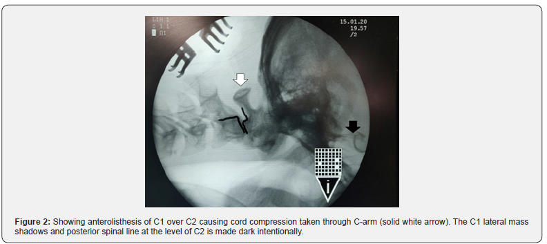 Click here to view Large Figure 2