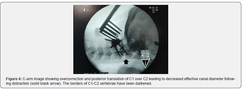 Click here to view Large Figure 4
