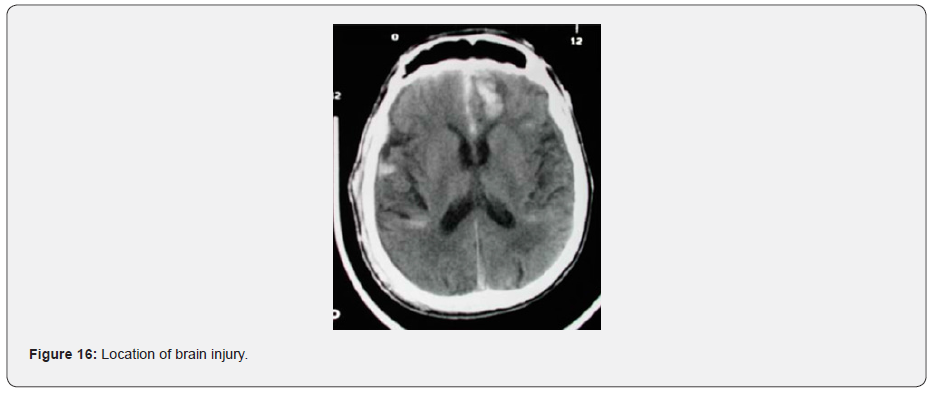 Click here to view Large Figure