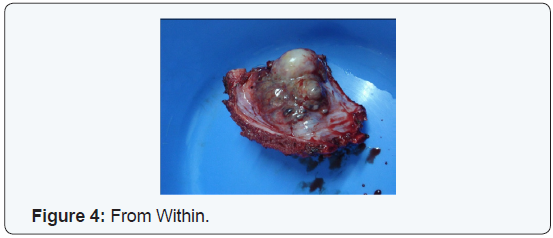 Click here to view Large Figure 4