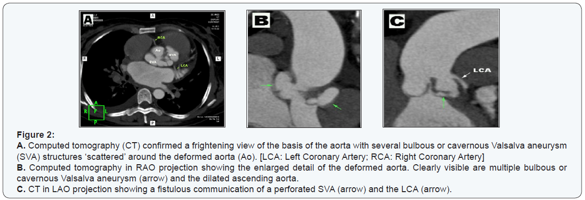 Click here to view Large Figure 2