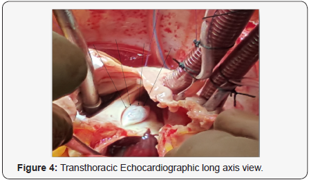 Click here to view Large Figure 4