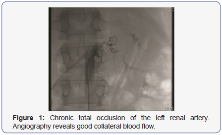 Click here to view Large Figure 1