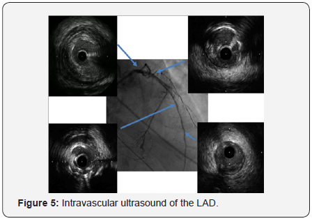 Click here to view Large Figure 5