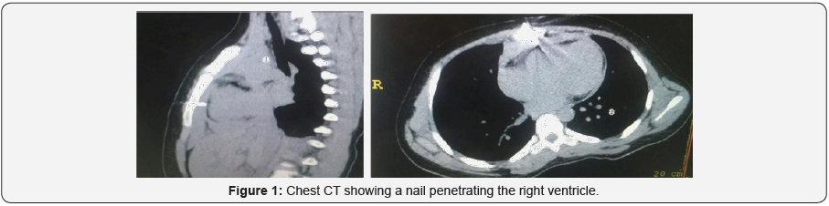 Click here to view Large Figure 1