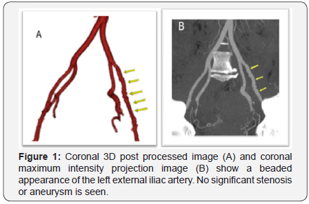 Click here to view Large Figure 1