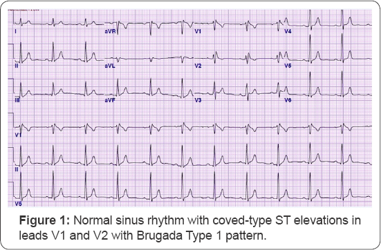 Click here to view Large Figure 1