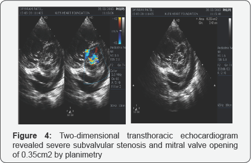 Click here to view Large Figure 4