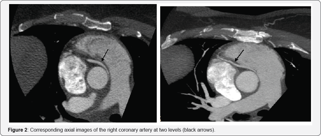 Click here to view Large Figure 2
