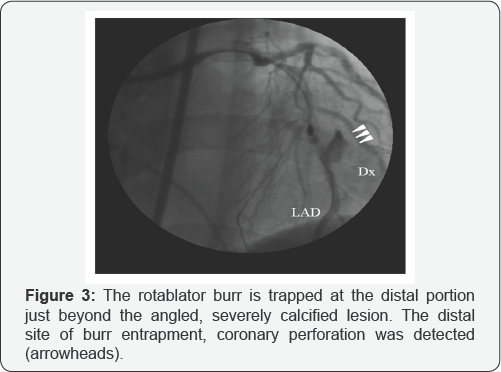 Click here to view Large Figure 1