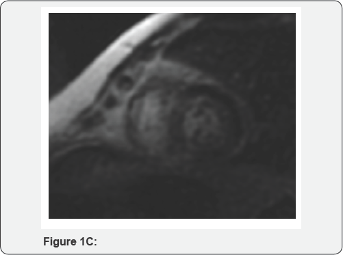 Click here to view Large Figure 1