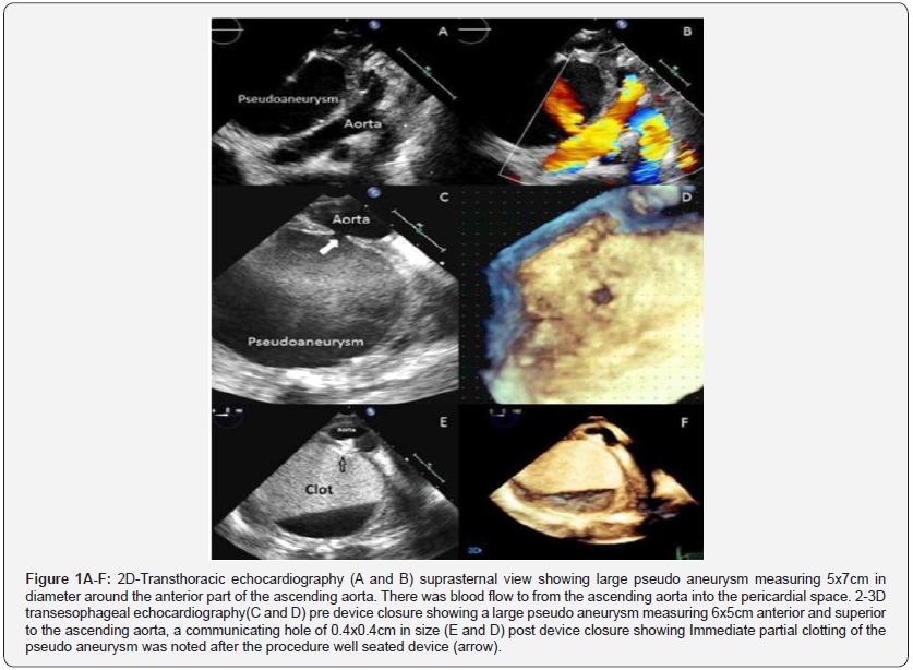 Click here to view Large Figure 1