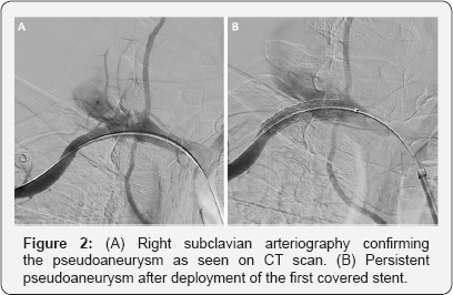 Click here to view Large Figure 2